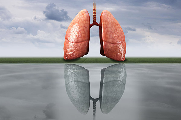 肺癌的15个征兆 肺癌的征兆有哪些