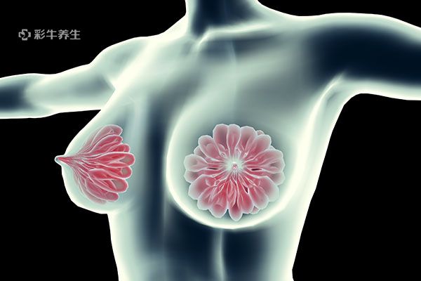 八乳腺癌的早期症状 参照自检及时发现