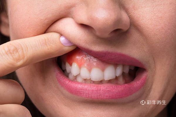 牙龈长泡是什么原因