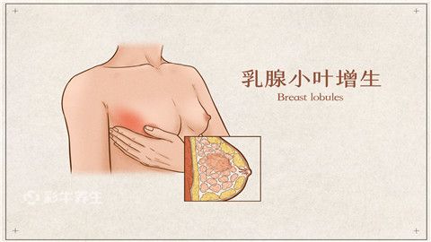 内衣引起胸部过敏_皮肤过敏图片