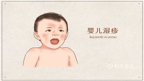 婴儿湿疹.jpg
