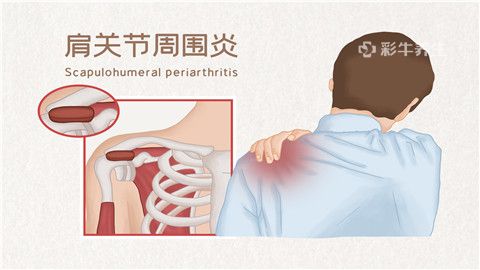 后背肩胛骨酸胀癌症图片