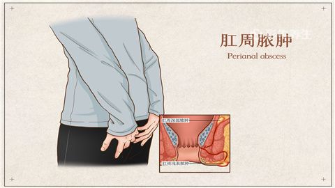 肛門癢疼怎麼回事