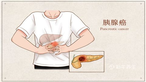 胰腺瘤能治好吗