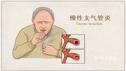 支气管炎症状(慢性支气管炎症状)-第1张图片-鲸幼网