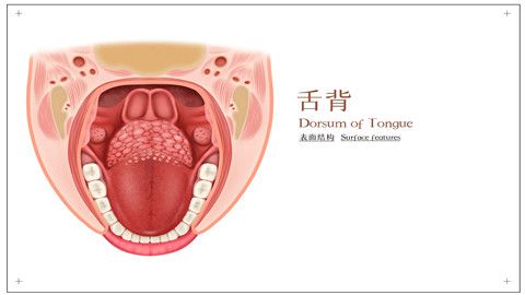 是舌癌的最常见症状之一;患者会感觉舌头常常疼痛