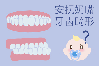 安抚奶嘴至牙齿变形图图片