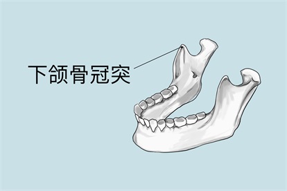 下颌骨茎突图片