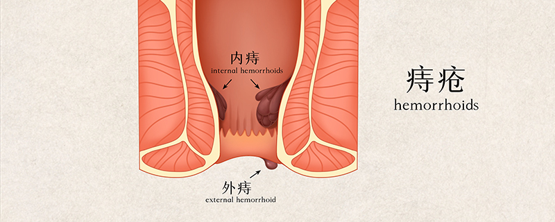 痔瘡為什么晚上特別癢