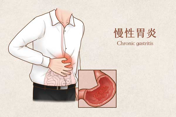 慢性胃炎医疗插画(企业商用)jpg